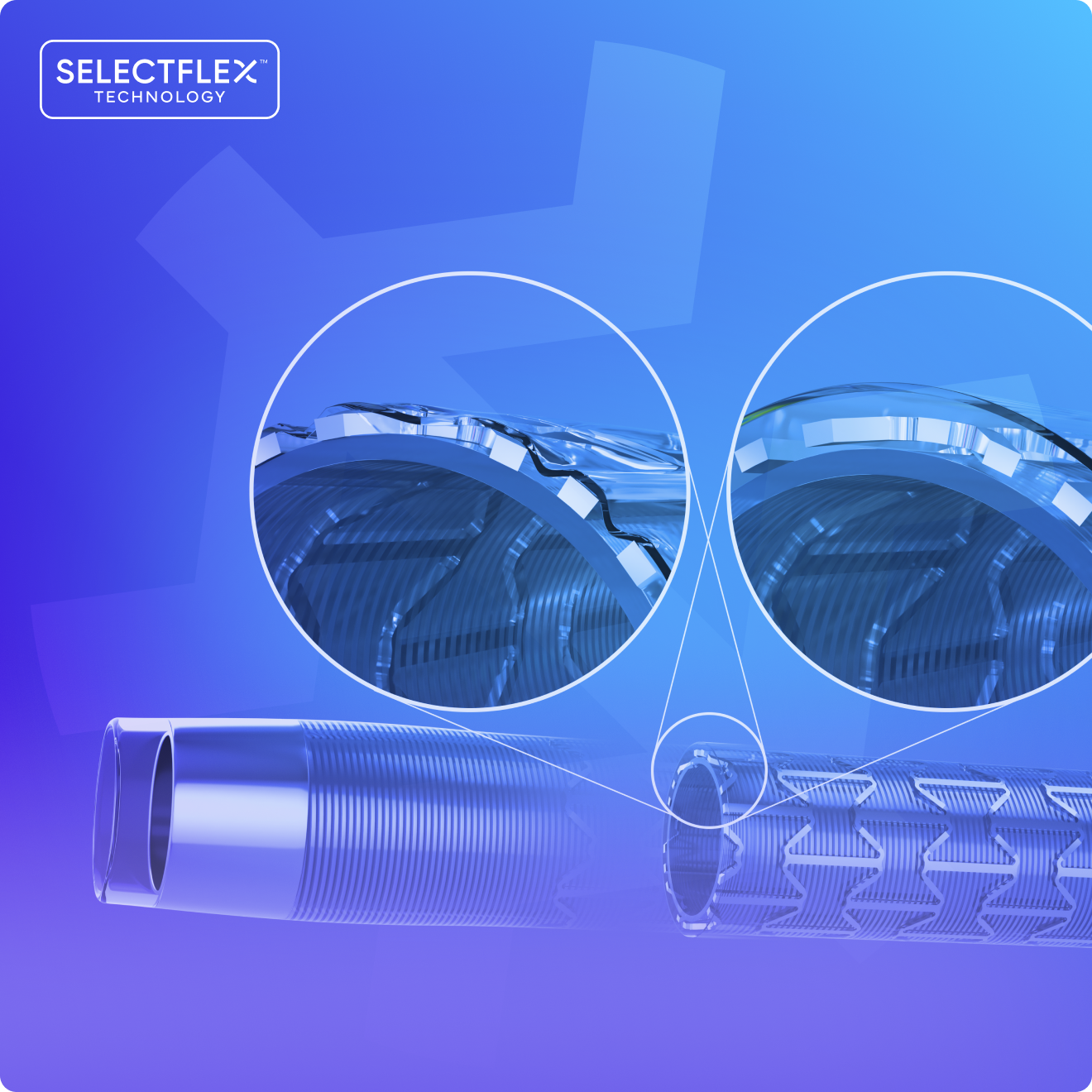 SelectFlex Technology