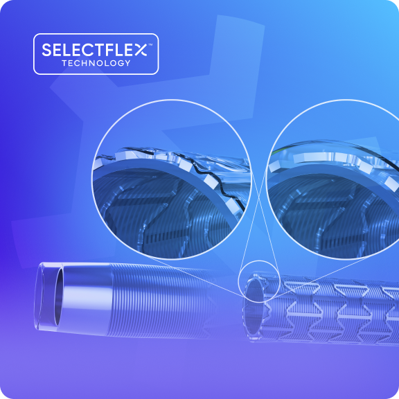 SelectFlex Technology